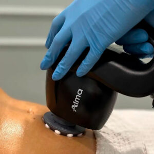 ALMA PRIMEX – Radiofrecuencia y Ultrasonido Facial y Corporal