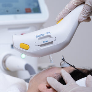 Stellar M22 (Fototerapia Avanzada)